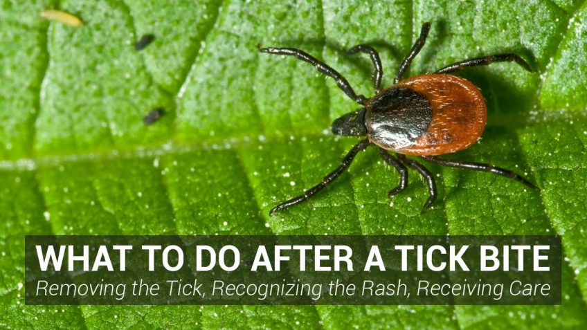 What to Do After a Tick Bite - Removing the Tick, Recognizing the Rash, Receiving Care