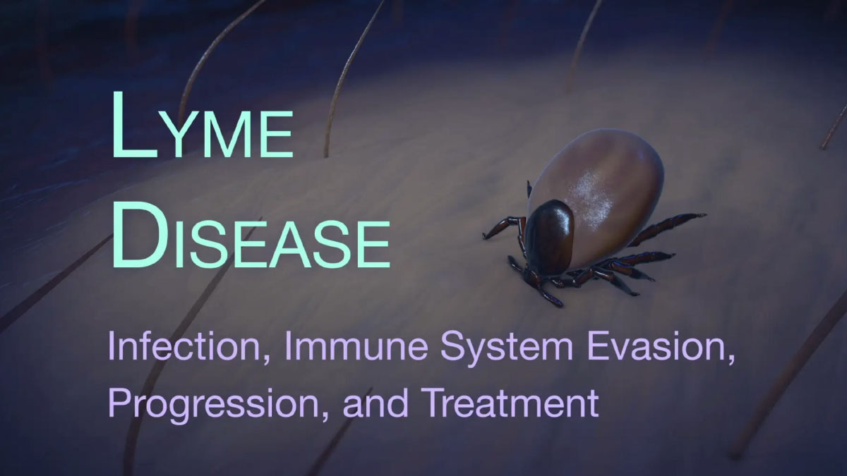 Lyme Disease Animation:  Infection, Immune System Evasion, & Progression