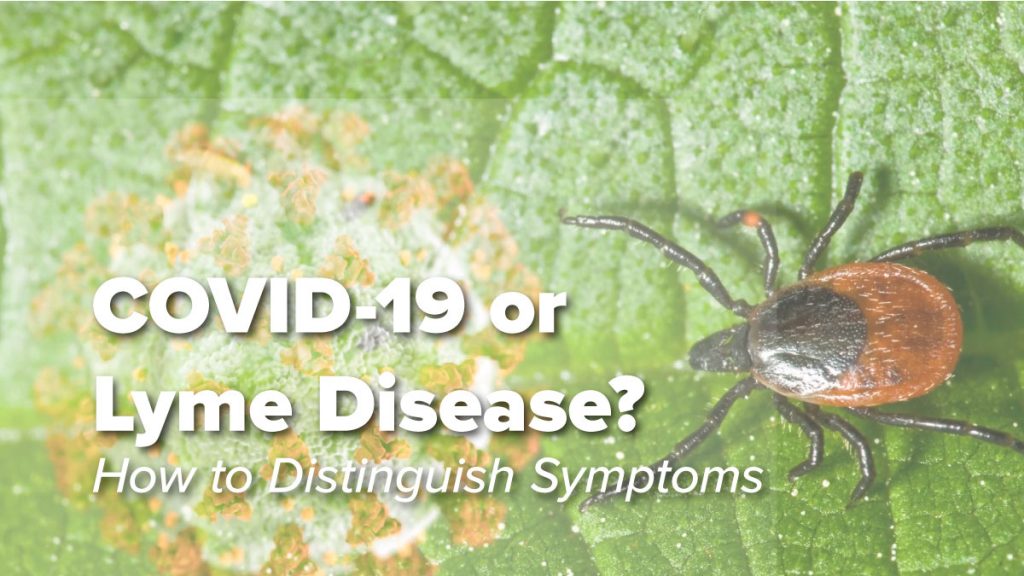 Think The Lyme Disease Rash Is Always A Bullseye Think Again Johns Think The Lyme Disease Rash Is Always A Bullseye Think Again Johns