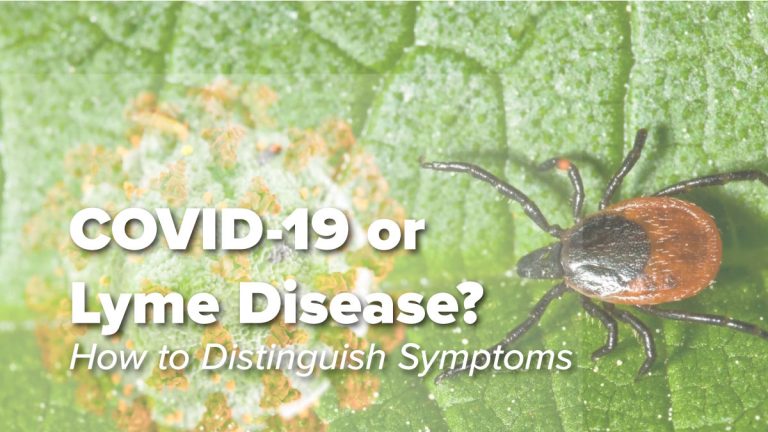 COVID-19 or Lyme Disease Featured