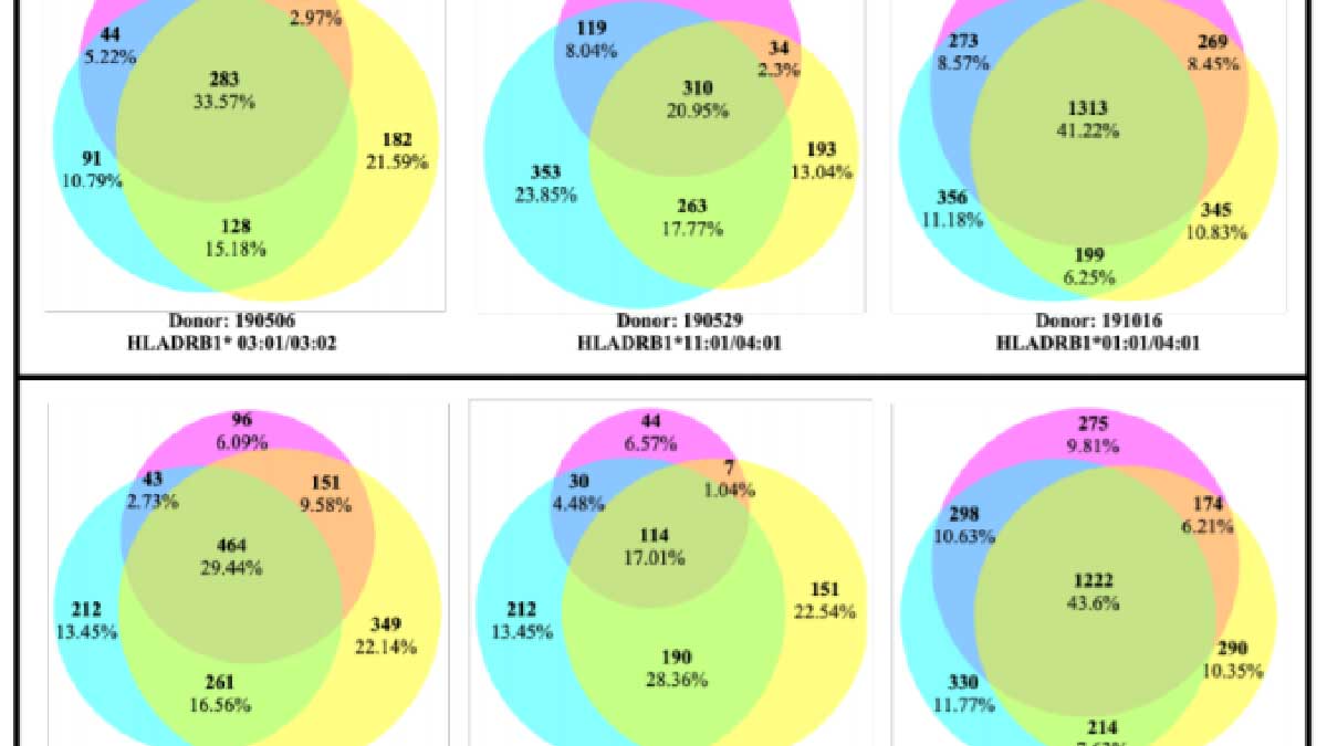 Lyme disease bacteria induce changes in self-immunopeptides expressed by dendritic cells