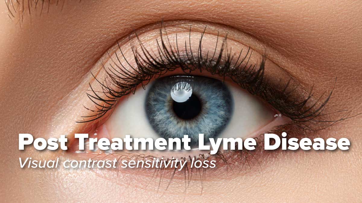 Visual contrast sensitivity loss in patients with post treatment Lyme disease