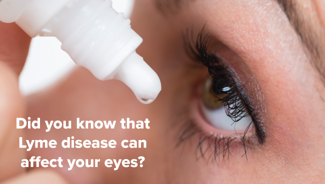 Did you know that Lyme disease can affect your eyes?